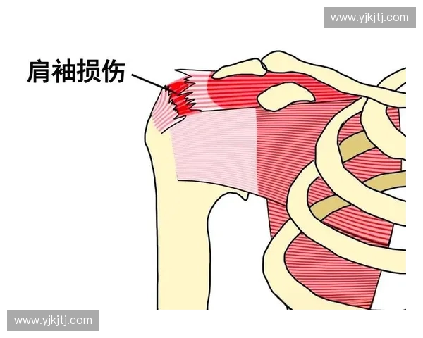 运动损伤预防与康复策略及功能恢复综合指南 运动损伤预防与康复策略及功能恢复综合指南